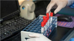 豪尔赛被立案 受损股民可索赔